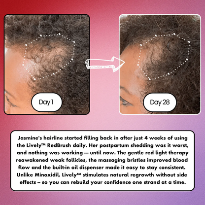 Lively™ RedBrush – Red Light Hair Regrowth & Scalp Therapy Comb